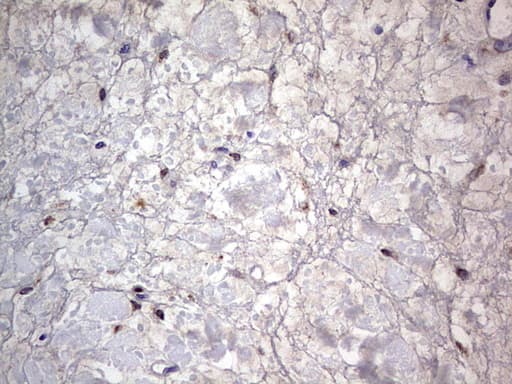 PRX-1 / PRRX1 Antibody (clone OTI1E10)