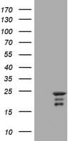 IHC-plus™ VILIP / VSNL1 Antibody (aa2-191, clone 2D5)
