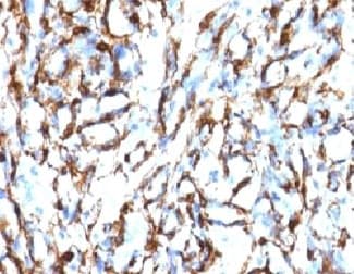 ACTA2 / Smooth Muscle Actin Antibody (clone SMAT2-1, Ready-to-Use)