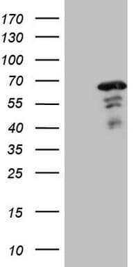 Monoclonal Mouse anti-Human MEF2D Antibody (clone OTI1E11, aa1-282, IHC, WB)
