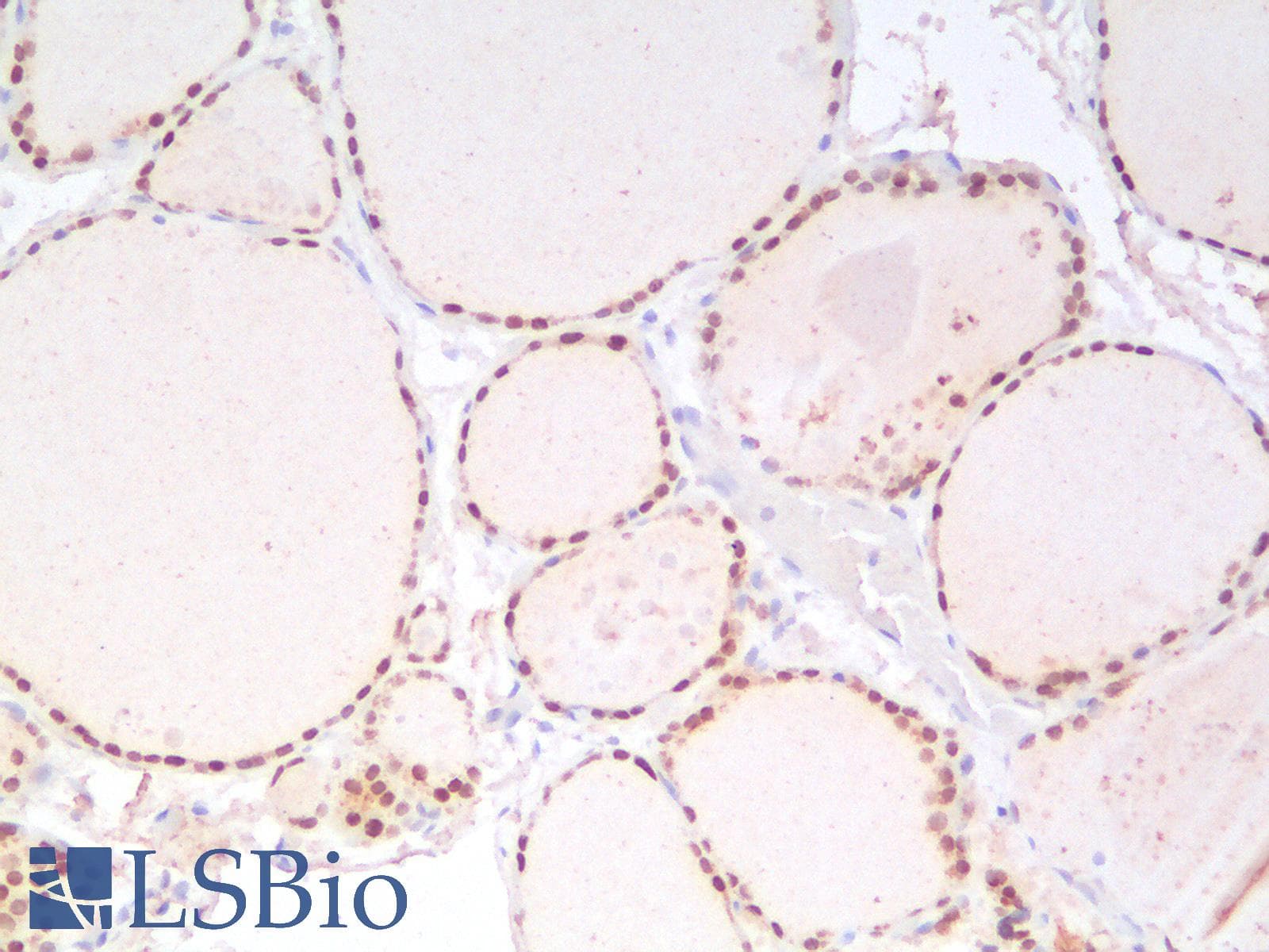 PathPlus™ Recombinant Monoclonal Mouse anti-Human NKX2-1 / Thyroid-Specific TF Antibody (clone rNX2.1/690, IHC)