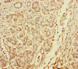 PLDN / Pallidin Antibody
