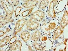 ATAD3B Antibody (aa1-240)