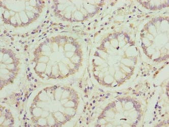JAGN1 Antibody