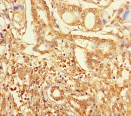 ZNF627 Antibody
