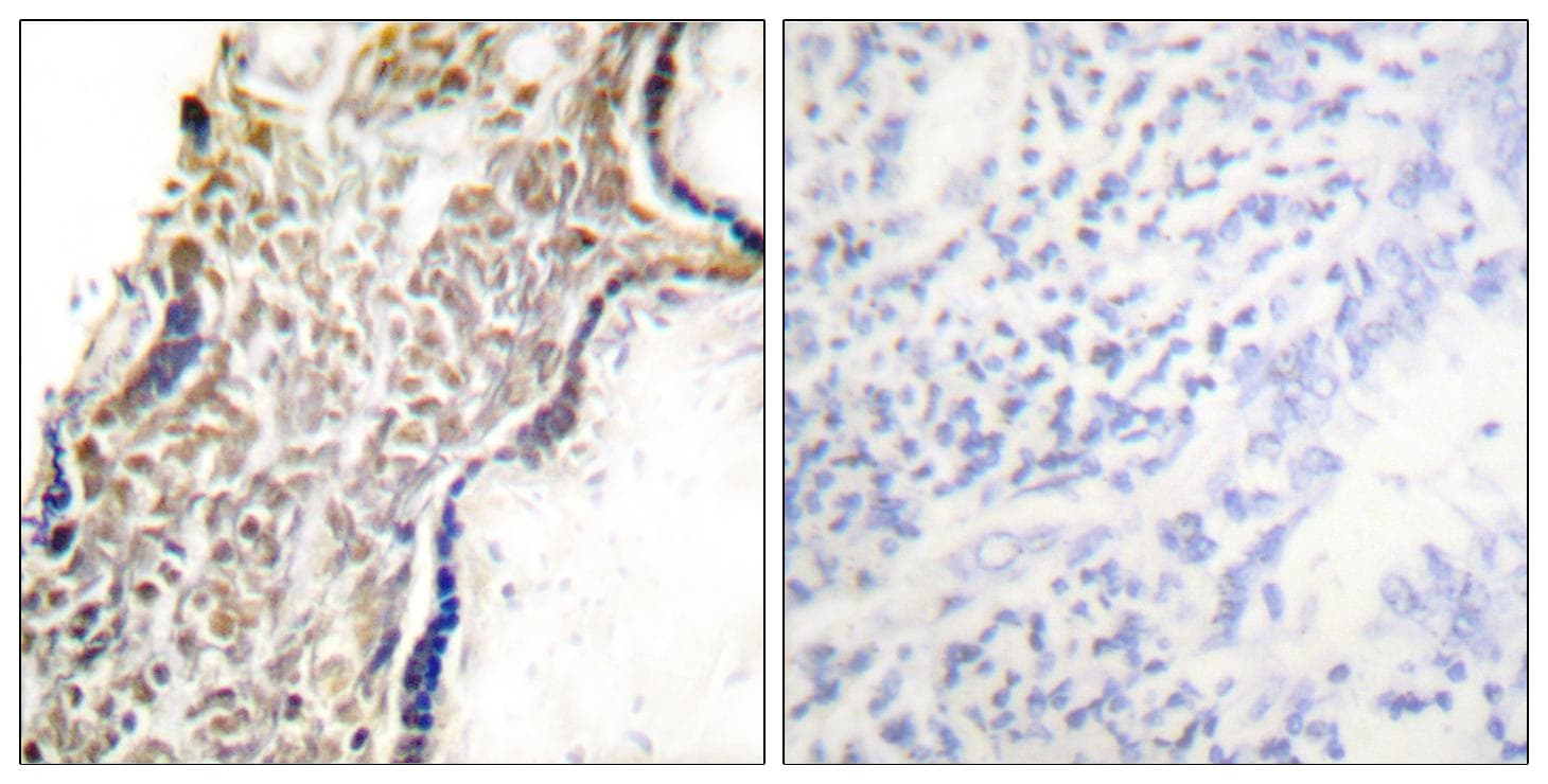 Polyclonal Rabbit anti-Human p14ARF / CDKN2A Antibody (IHC, IF, WB)