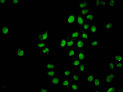 HIST1H2BN Antibody