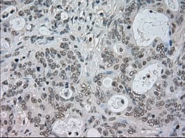 CTAG1B / NY-ESO-1 Antibody (clone OTI2B6)