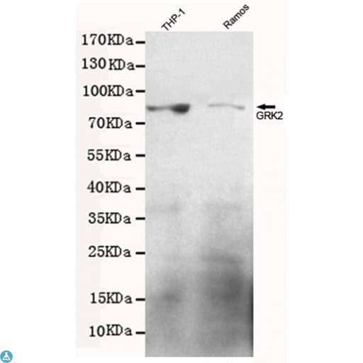 ADRBK1 / GRK2 Antibody