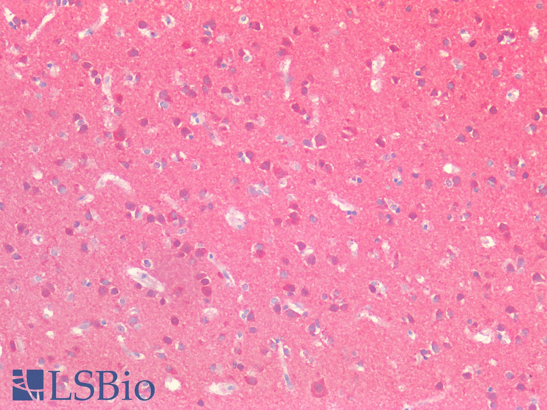 IHC-plus™ HPRT1 / HPRT Antibody (aa23-218)