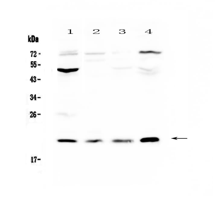 KLK2 / Kallikrein 2 Antibody