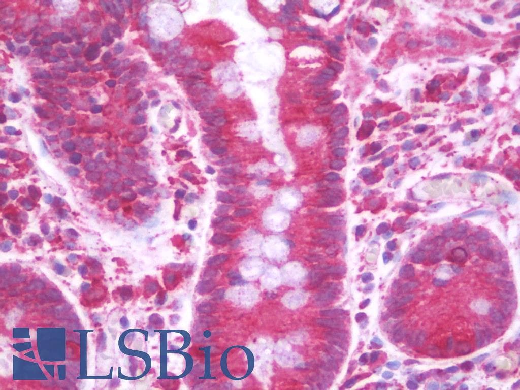 IHC-plus™ Polyclonal Chicken anti-Human SDHAF2 Antibody (IHC, WB)