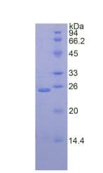 Human DSC1 / Desmocollin 1 Protein (Recombinant His)