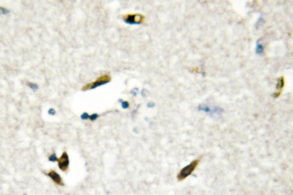 RBMX Antibody (Met40)