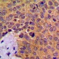 CTSD / Cathepsin D Antibody (Internal)