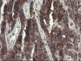 EIF5A2 Antibody (clone OTI6G7)