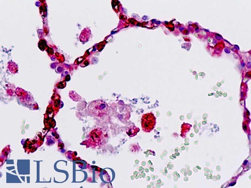IHC-plus™ Polyclonal Rabbit anti-Human DEPDC5 Antibody (aa1404-1432, IHC, WB)