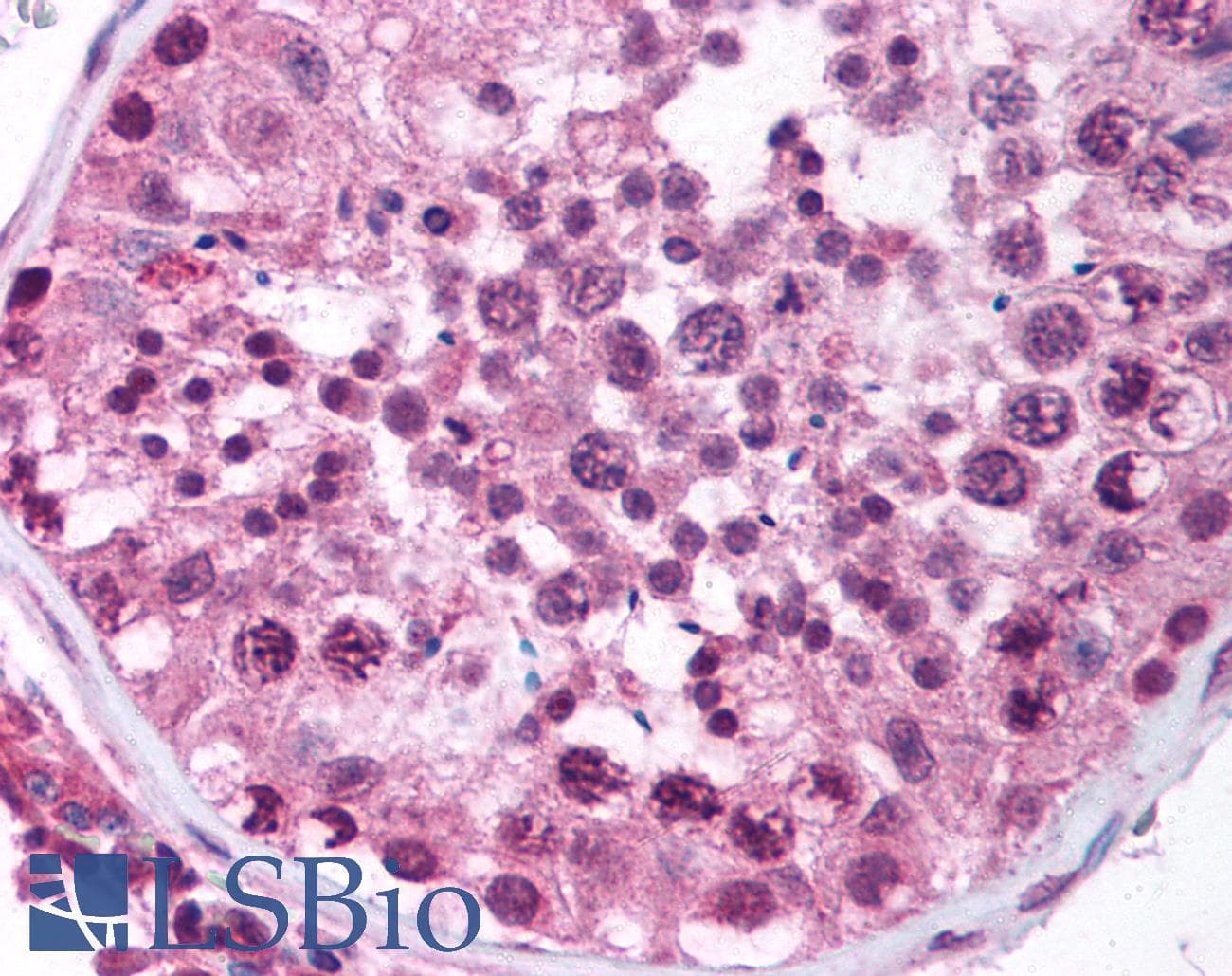 IHC-plus™ MLLT10 Antibody (aa1013-1027)