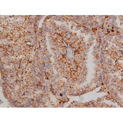 SYN / FYN Antibody (phospho-Tyr530)