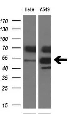IHC-plus™ Monoclonal Mouse anti-Human TDO2 Antibody (clone 4G2, IHC, WB)