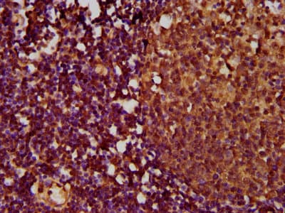 TNFRSF18 / GITR Antibody