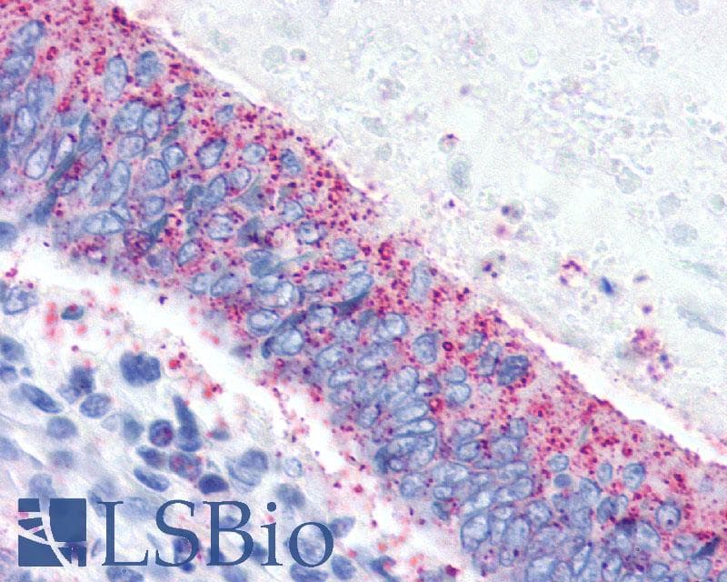 IHC-plus™ Polyclonal Rabbit anti-Human CRHR2 / CRF2 Receptor Antibody (N-Terminus, IHC)