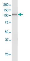 EPHA3 / EPH Receptor A3 Antibody (clone 3A12)