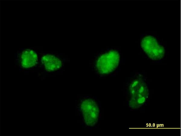 IHC-plus™ MKNK1 / MNK1 Antibody (clone 2F12)