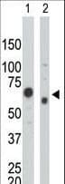 PKM / Pyruvate Kinase, Muscle Antibody (aa121-151)