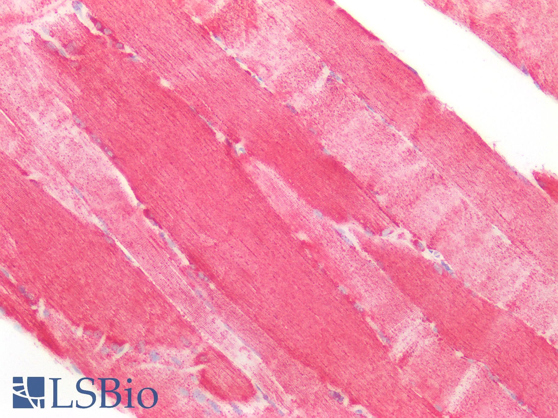 PathPlus™ SOD2 / Mn SOD Antibody (aa119-130)