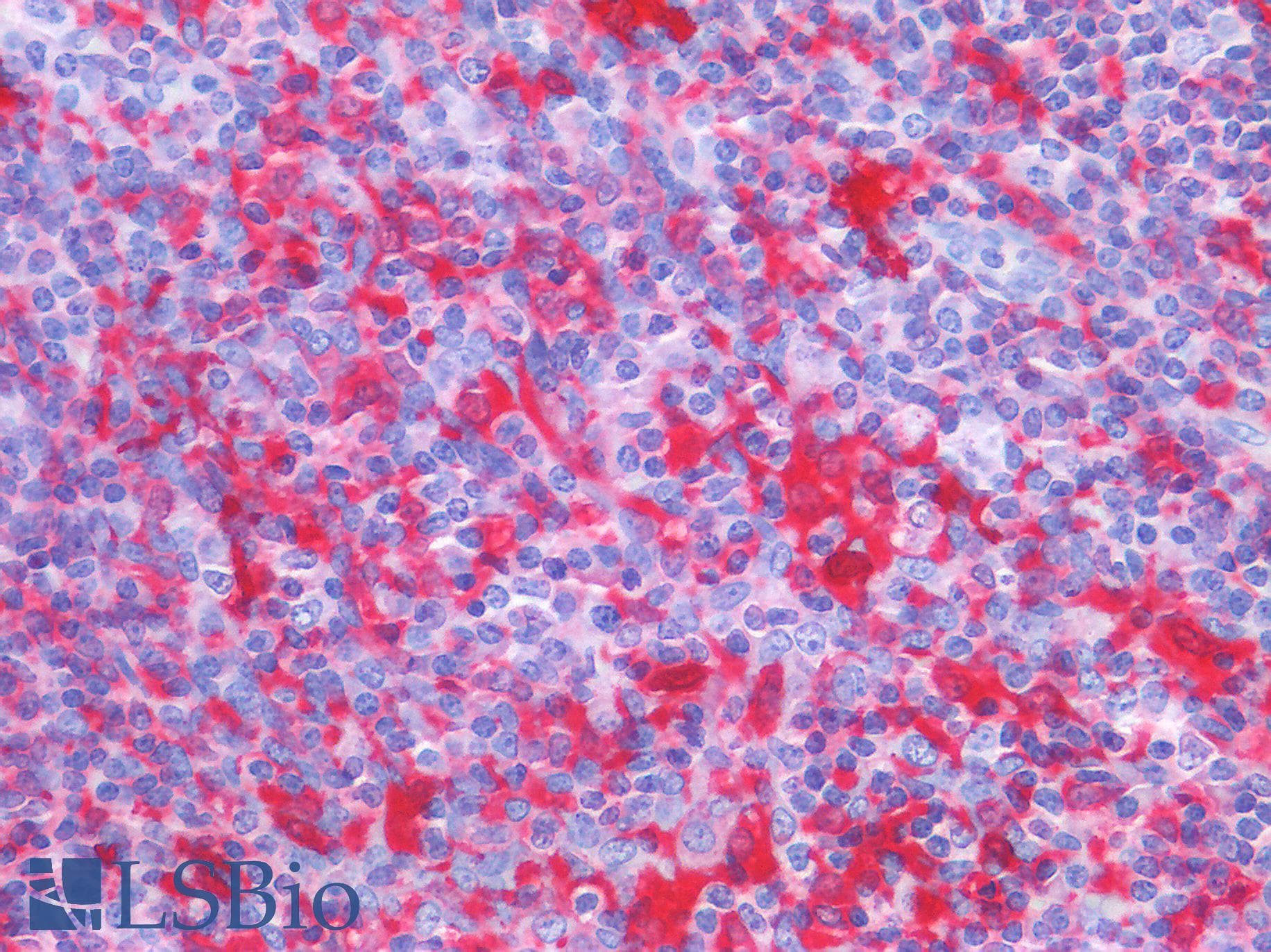 IHC-plus™ CD45 / LCA Antibody