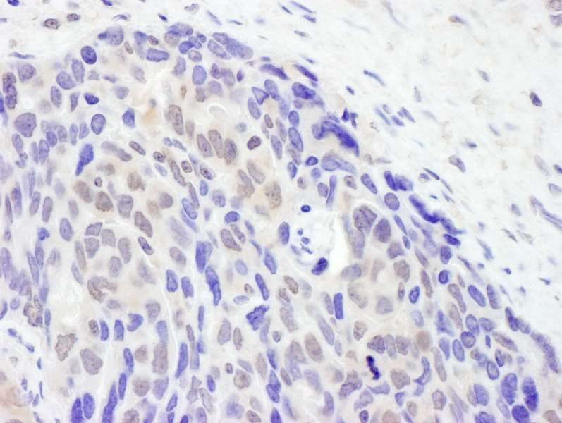 TET2 Antibody (aa100-150)