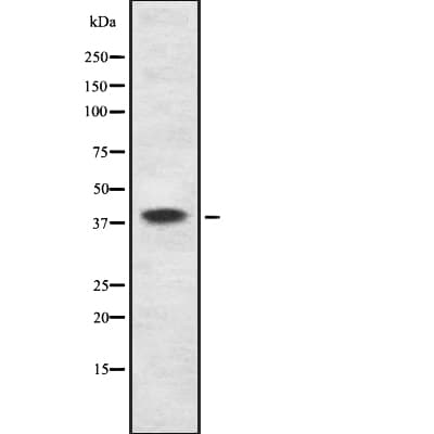 DAPK2 / DAP Kinase 2 Antibody