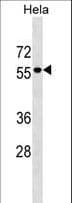 AMIGO3 Antibody (aa242-268)