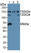 NUP155 Antibody (aa1154-1379)