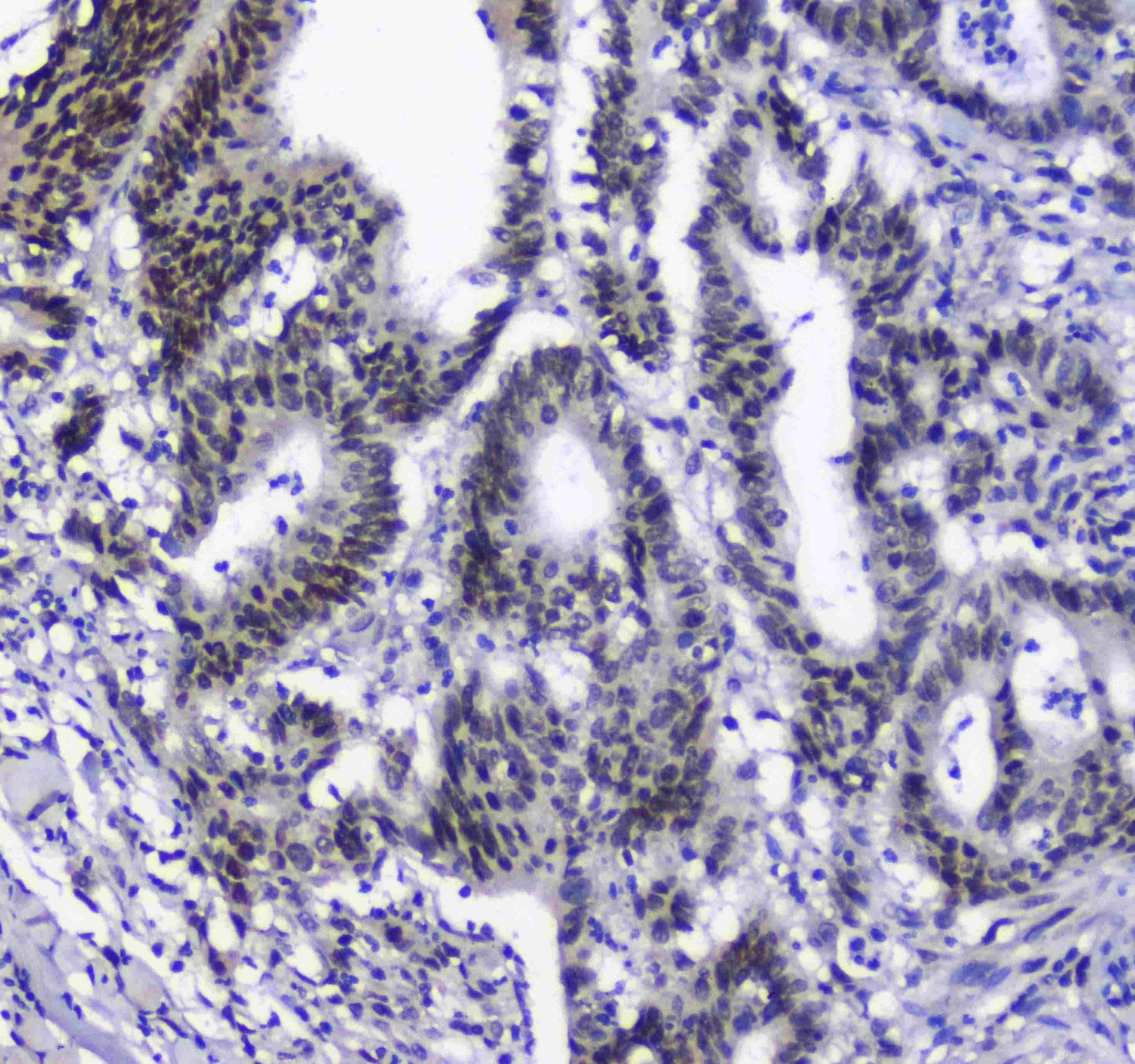 SF1 Antibody