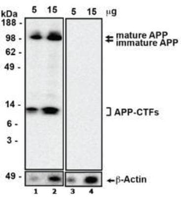 APP / Beta Amyloid Precursor Antibody (clone MOAB-2)