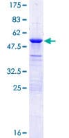 Human APIP Protein (Recombinant GST)