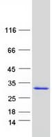 Human ALKBH7 Protein (Recombinant Myc-DDK (Flag))