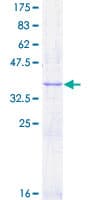 Human FLT1 / VEGFR1 Protein (Recombinant GST, N-terminus)