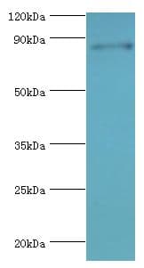Polyclonal Rabbit anti-Human STAT4 Antibody (aa569-748, IHC, WB)