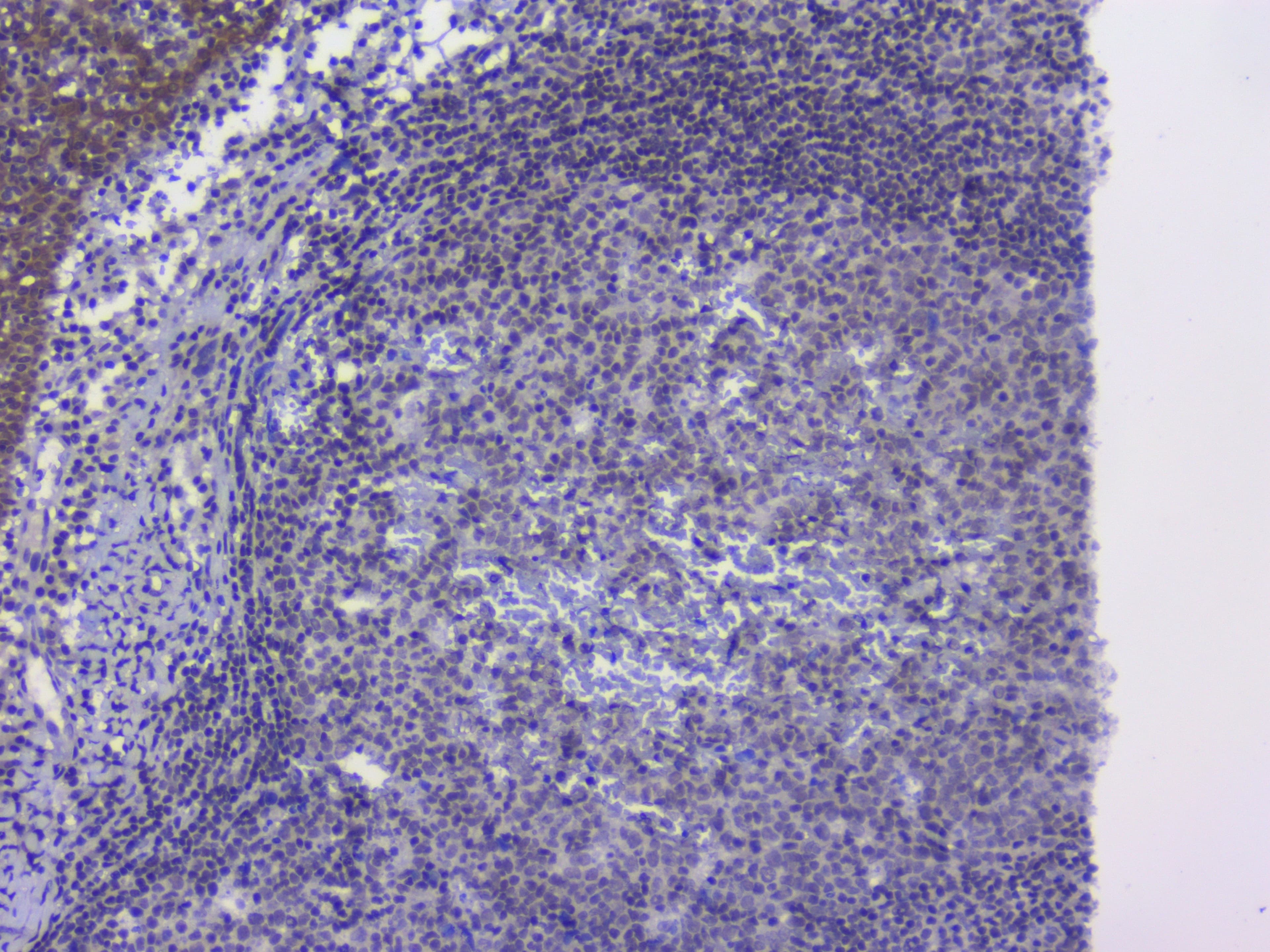 NRF1 / NRF-1 Antibody