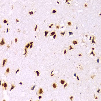 Polyclonal Rabbit anti-Human Histone H3 Antibody (IHC, IF, WB)