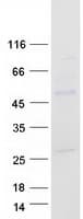 Human MYC / c-Myc Protein (Recombinant Myc-DDK (Flag))
