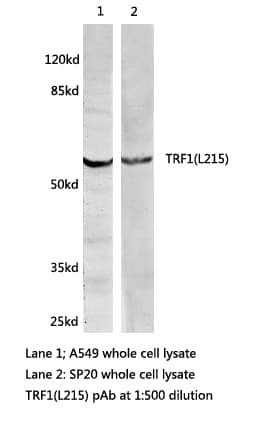 TRF1 / TERF1 Antibody (Leu215)