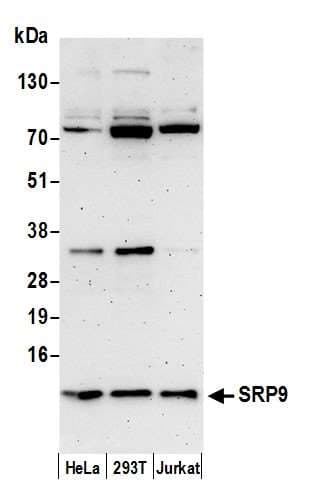 Polyclonal Rabbit anti-Human SRP9 Antibody (aa36-86, WB)