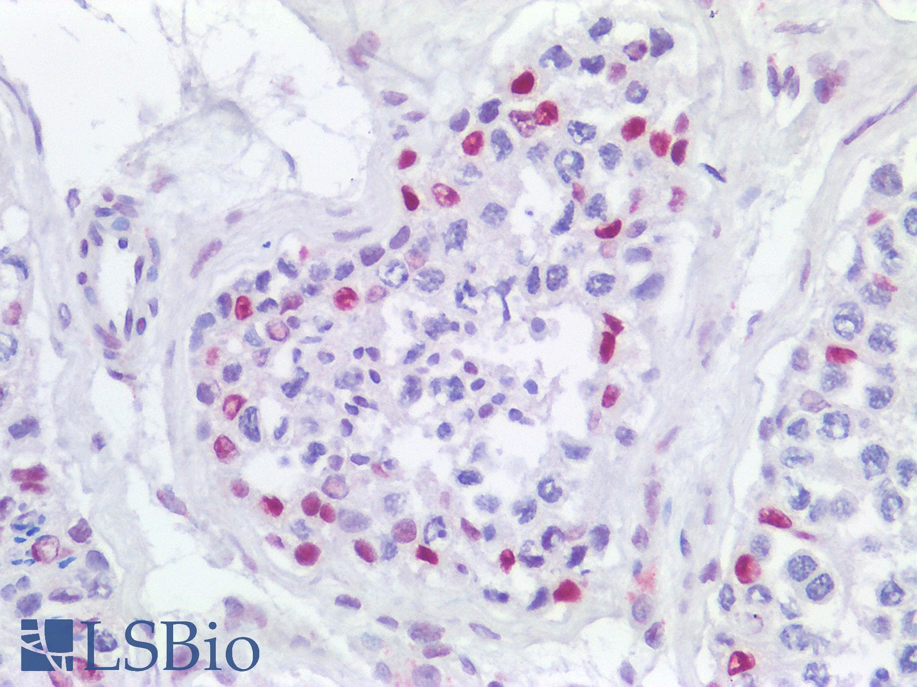IHC-plus™ POLR2A / RNA polymerase II Antibody (1560-1640 aa)
