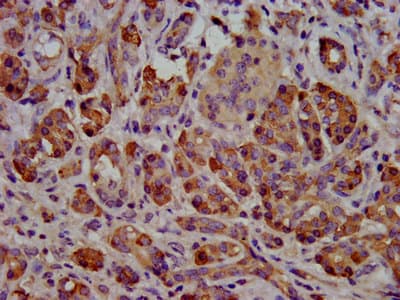 CEL / Carboxyl Ester Lipase Antibody