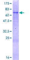 Human ABHD16B / C20orf135 Protein (Recombinant GST)
