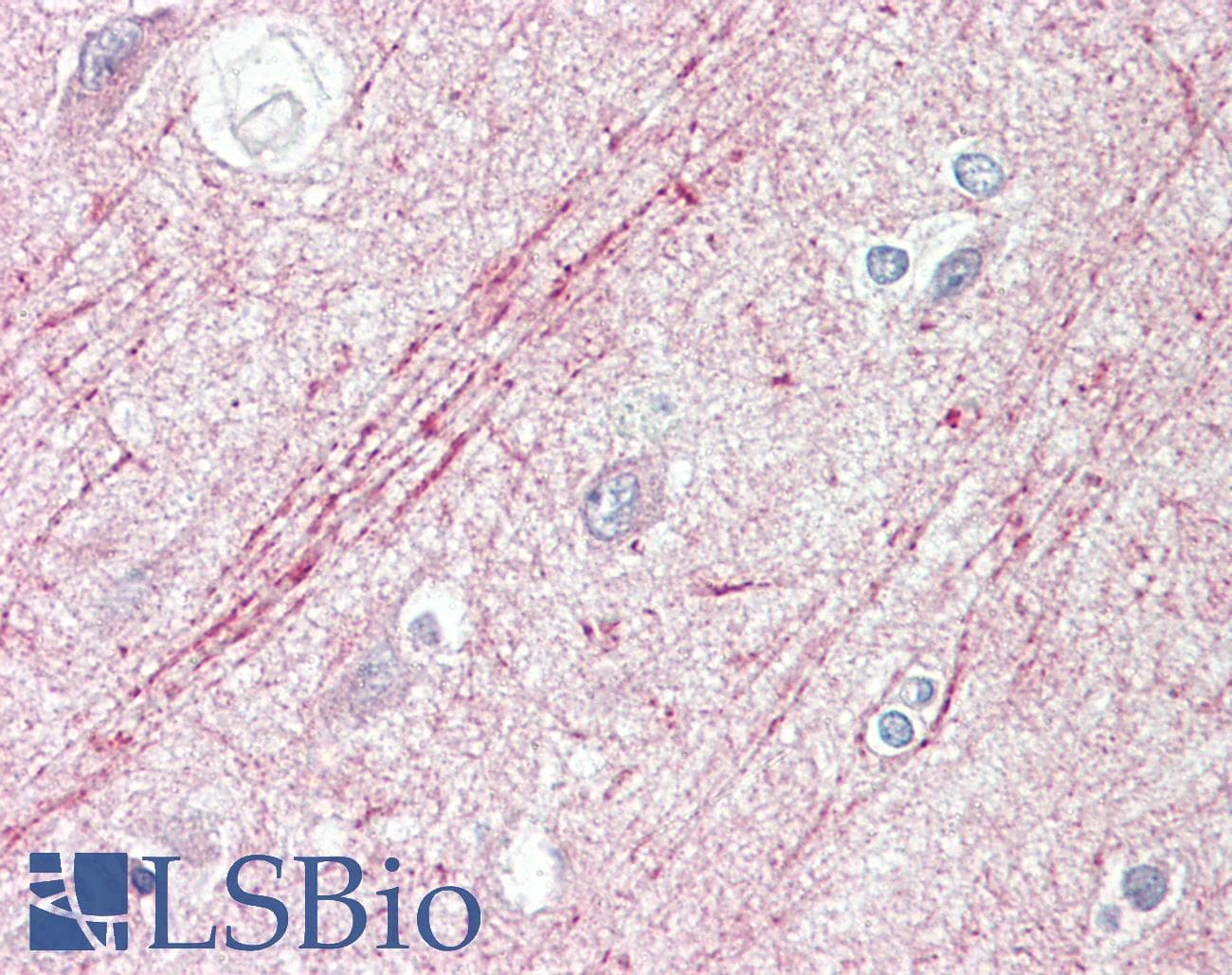 IHC-plus™ Polyclonal Rabbit anti-Human SLIT1 Antibody (aa84-113, IHC, WB)